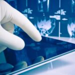 Jaką rolę pełni RTG w diagnostyce urazów?